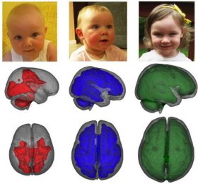 Lactancia materna y desarrollo cerebral del bebé