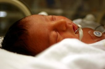 Membrana hialina bebé prematuro