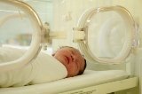 Apnea del sueño en el bebé prematuro