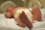 Persistencia circulación fetal bebé prematuro
