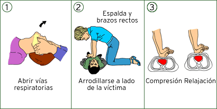 Técnica de reanimación pulmonar